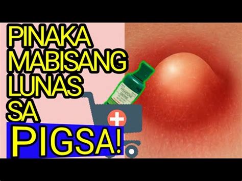pinakamabisang gamot sa coryza|Mabisang Gamot Sa Pigsa .
